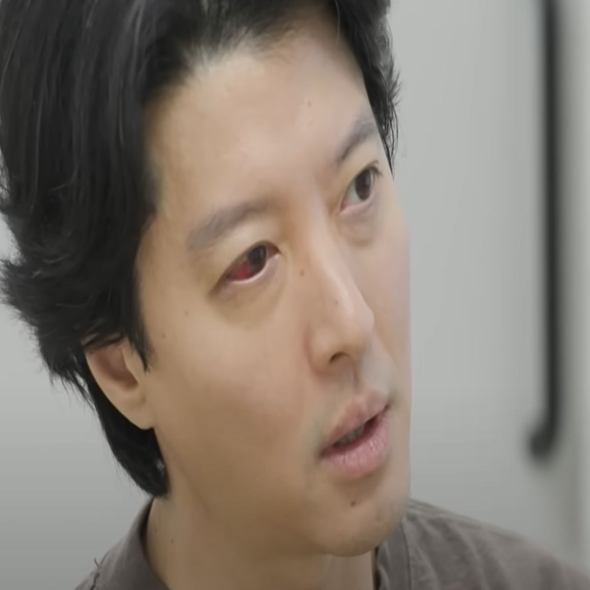 ‘Lovers in Paris’ actor Lee Dong-Gun, na-diagnose na may isang rare disease